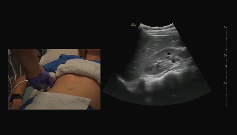 УЗИ брюшной полости на дому