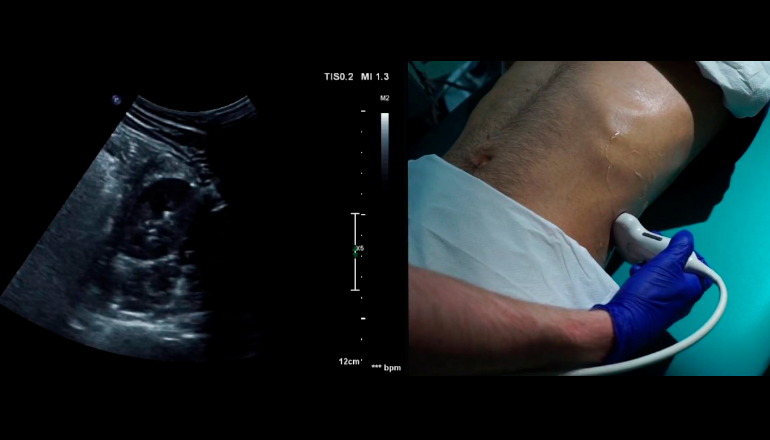 УЗИ мочевого пузыря на дому