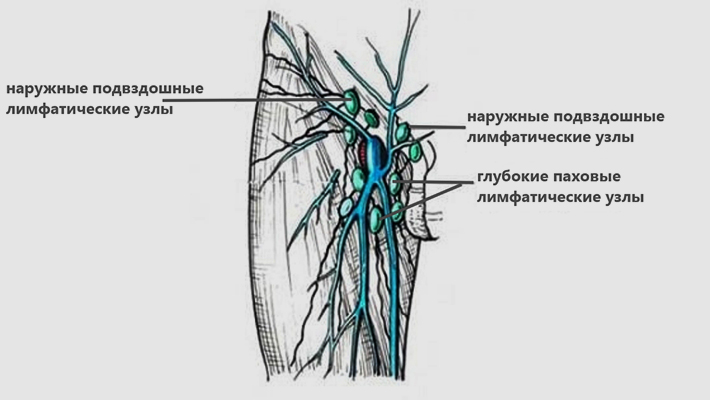УЗИ паховых лимфоузлов